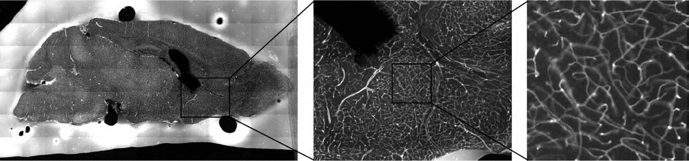 Graphic: A section of a mouse brain. The overall image is $6656{\rm x}3584$, yet the vessels of interest are 2-3 pixels wide