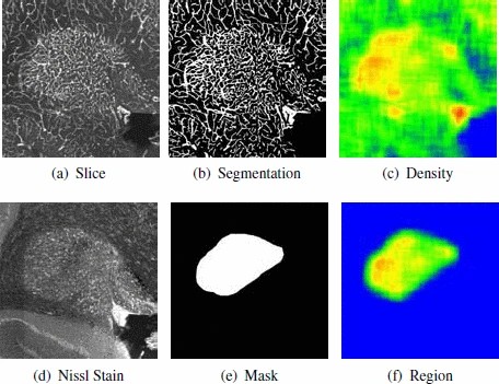 Graphic: The Nissl stain view of the slice allows an anatomist to identify the cerebellar nucleus. Computations can be performed in this region